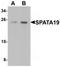 Spermatogenesis Associated 19 antibody, TA320146, Origene, Western Blot image 