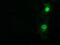 5'-Nucleotidase Domain Containing 1 antibody, GTX83991, GeneTex, Immunocytochemistry image 