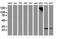 Pyrroline-5-Carboxylate Reductase 3 antibody, NBP2-03337, Novus Biologicals, Western Blot image 
