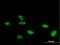 Zinc Finger Protein 507 antibody, H00022847-B01P, Novus Biologicals, Immunocytochemistry image 