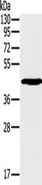 Signaling lymphocytic activation molecule antibody, TA349759, Origene, Western Blot image 