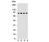 Neuregulin 2 antibody, R30720, NSJ Bioreagents, Western Blot image 