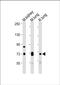 Delta Like Canonical Notch Ligand 4 antibody, PA5-72350, Invitrogen Antibodies, Western Blot image 