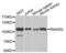 2-5A-dependent ribonuclease antibody, PA5-76443, Invitrogen Antibodies, Western Blot image 