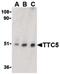Tetratricopeptide Repeat Domain 5 antibody, PA5-20011, Invitrogen Antibodies, Western Blot image 
