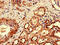 Chromosome 1 Open Reading Frame 189 antibody, LS-C399161, Lifespan Biosciences, Immunohistochemistry paraffin image 