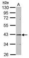 ST8 Alpha-N-Acetyl-Neuraminide Alpha-2,8-Sialyltransferase 2 antibody, PA5-31343, Invitrogen Antibodies, Western Blot image 