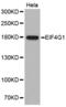 Eukaryotic translation initiation factor 4 gamma 1 antibody, abx000885, Abbexa, Western Blot image 