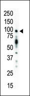 Protein Kinase D1 antibody, 62-597, ProSci, Western Blot image 