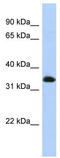 Zinc Finger Protein 511 antibody, TA331639, Origene, Western Blot image 