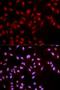 c-met antibody, LS-C335772, Lifespan Biosciences, Immunofluorescence image 