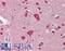 Growth Differentiation Factor 5 antibody, LS-B8753, Lifespan Biosciences, Immunohistochemistry frozen image 
