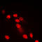 Spectrin Repeat Containing Nuclear Envelope Family Member 3 antibody, LS-B13050, Lifespan Biosciences, Immunofluorescence image 