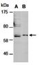 Perforin 1 antibody, orb67011, Biorbyt, Western Blot image 