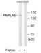 Patatin Like Phospholipase Domain Containing 6 antibody, TA315123, Origene, Western Blot image 