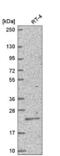 Homeobox protein TGIF1 antibody, NBP2-55829, Novus Biologicals, Western Blot image 