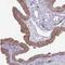 Exosome Component 8 antibody, HPA039702, Atlas Antibodies, Immunohistochemistry frozen image 