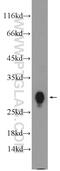 MHC II HLA-DR beta antibody, 15862-1-AP, Proteintech Group, Western Blot image 