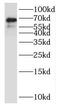 Neurotrimin antibody, FNab05885, FineTest, Western Blot image 