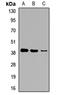G Protein Subunit Alpha 14 antibody, orb411760, Biorbyt, Western Blot image 