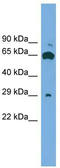 GLIPR1 Like 1 antibody, TA329798, Origene, Western Blot image 