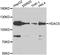 Histone Deacetylase 5 antibody, A7189, ABclonal Technology, Western Blot image 