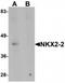Homeobox protein Nkx-2.2 antibody, TA319689, Origene, Western Blot image 