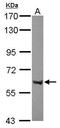 ZFP69 Zinc Finger Protein antibody, GTX120548, GeneTex, Western Blot image 