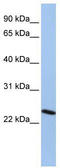 Chromobox protein homolog 7 antibody, TA335362, Origene, Western Blot image 