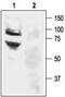 Amiloride-sensitive cation channel 3 antibody, TA329041, Origene, Western Blot image 