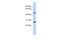 Zinc Finger Protein 556 antibody, A17634, Boster Biological Technology, Western Blot image 