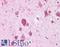 CAPS1 antibody, LS-B4590, Lifespan Biosciences, Immunohistochemistry paraffin image 