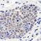 COP9 Signalosome Subunit 3 antibody, IHC-00111, Bethyl Labs, Immunohistochemistry paraffin image 