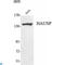 Ubiquitin Specific Peptidase 7 antibody, LS-C812982, Lifespan Biosciences, Western Blot image 