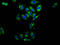 Receptor activity-modifying protein 2 antibody, LS-C675083, Lifespan Biosciences, Immunofluorescence image 