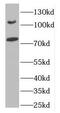 Discs Large MAGUK Scaffold Protein 5 antibody, FNab02411, FineTest, Western Blot image 