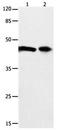 Damage Specific DNA Binding Protein 1 antibody, orb107496, Biorbyt, Western Blot image 