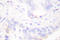 CRK Proto-Oncogene, Adaptor Protein antibody, LS-C175979, Lifespan Biosciences, Immunohistochemistry frozen image 