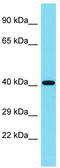 Ribosomal protein S6 modification-like protein B antibody, TA344769, Origene, Western Blot image 