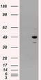 Proteasome 26S Subunit, ATPase 3 antibody, TA500929S, Origene, Western Blot image 
