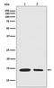 Histone Cluster 1 H2A Family Member E antibody, M16777-1, Boster Biological Technology, Western Blot image 