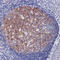 BCL6 Transcription Repressor antibody, LS-C88252, Lifespan Biosciences, Immunohistochemistry paraffin image 