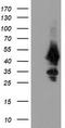 Ubiquitin Conjugating Enzyme E2 J1 antibody, CF504975, Origene, Western Blot image 