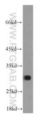 Adenylate kinase 2, mitochondrial antibody, 66127-1-Ig, Proteintech Group, Western Blot image 