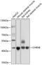 Cholinergic Receptor Nicotinic Epsilon Subunit antibody, GTX64807, GeneTex, Western Blot image 