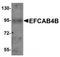 EF-hand calcium-binding domain-containing protein 4B antibody, TA320057, Origene, Western Blot image 
