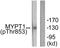 Protein Phosphatase 1 Regulatory Subunit 12A antibody, LS-C199297, Lifespan Biosciences, Western Blot image 