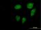 Variable charge X-linked protein 3 antibody, H00051481-B01P, Novus Biologicals, Immunocytochemistry image 