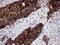 Carcinoembryonic Antigen Related Cell Adhesion Molecule 6 antibody, LS-C794814, Lifespan Biosciences, Immunohistochemistry paraffin image 