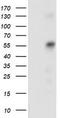 Sequestosome-1 antibody, CF502129, Origene, Western Blot image 